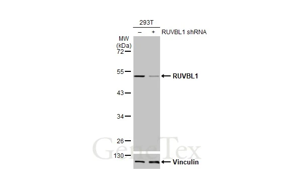 Non-transfected (–) and transfected (+) 293T whole cell extracts (30 μg) were separated by 10% SDS-PAGE, and the membrane was blotted with RUVBL1 antibody (GTX111294) diluted at 1:5000. The HRP-conjugated anti-rabbit IgG antibody (GTX213110-01) was used to detect the primary antibody. Non-transfected (–) and transfected (+) 293T whole cell extracts (30 μg) were separated by 10% SDS-PAGE, and the membrane was blotted with RUVBL1 antibody (GTX111294) diluted at 1:5000. The HRP-conjugated anti-rabbit IgG antibody (GTX213110-01) was used to detect the primary antibody.