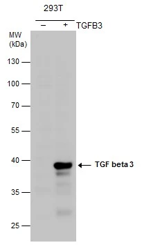 TGF beta 3 antibody detects TGF beta 3 protein by western blot analysis. Non-transfected (-) and TGF beta 3-transfected (+) 293T whole cell extracts (30 μg) were separated by 10% SDS-PAGE, and the membrane was blotted with TGF beta 3 antibody (GTX111296) diluted at 1:5000.