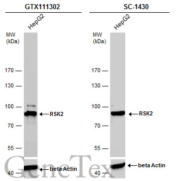 Whole cell extract (30 μg) was separated by 7.5% SDS-PAGE, and the membranes were blotted with RSK2 antibody (GTX111302) diluted at 1:5000 and competitor's antibody (SC-1430) diluted by 1:1000. The HRP-conjugated anti-rabbit IgG antibody (GTX213110-01) was used to detect the primary antibody.