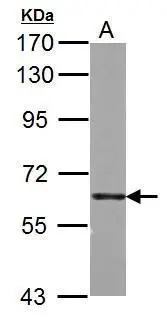 PKM antibody