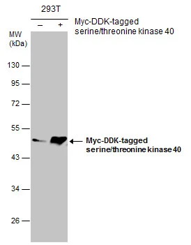 Non-transfected (–) and transfected (+) 293T whole cell extracts (30 μg) were separated by 10% SDS-PAGE, and the membrane was blotted with serine/threonine kinase 40 antibody [N3C3] (GTX111337) diluted at 1:5000.