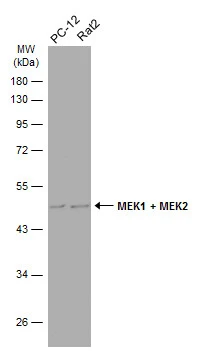 Various whole cell extracts (30 μg) were separated by 10% SDS-PAGE, and the membrane was blotted with MEK1 + MEK2 antibody (GTX111338) diluted at 1:500. The HRP-conjugated anti-rabbit IgG antibody (GTX213110-01) was used to detect the primary antibody. Various whole cell extracts (30 μg) were separated by 10% SDS-PAGE, and the membrane was blotted with MEK1 + MEK2 antibody (GTX111338) diluted at 1:500. The HRP-conjugated anti-rabbit IgG antibody (GTX213110-01) was used to detect the primary antibody.