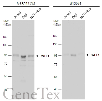 Various whole cell extracts (30 μg) were separated by 7.5% SDS-PAGE, and the membranes were blotted with WEE1 antibody [N3C2], Internal (GTX111392) diluted at 1:1000 and competitor's antibody (CST#13084) diluted at 1:1000. The HRP-conjugated anti-rabbit IgG antibody (GTX213110-01) was used to detect the primary antibody.