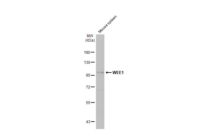 Mouse tissue extract (50 μg) was separated by 7.5% SDS-PAGE, and the membrane was blotted with WEE1 antibody [N3C2], Internal (GTX111392) diluted at 1:1000. The HRP-conjugated anti-rabbit IgG antibody (GTX213110-01) was used to detect the primary antibody.
