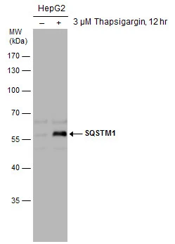 Untreated (–) and treated (+) HepG2 whole cell extracts (30 μg) were separated by 10% SDS-PAGE, and the membrane was blotted with SQSTM1 antibody (GTX111393) diluted at 1:10000.
