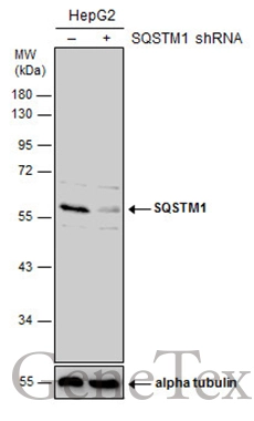 Untreated (�) and treated (+) HepG2 whole cell extracts (30 ug) were separated by 10% SDS-PAGE,and the membrane was blotted with SQSTM1 antibody (GTX111393) diluted at 1:10000.
