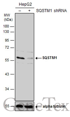Anti-SQSTM1 / P62 antibody (GTX111393) | GeneTex