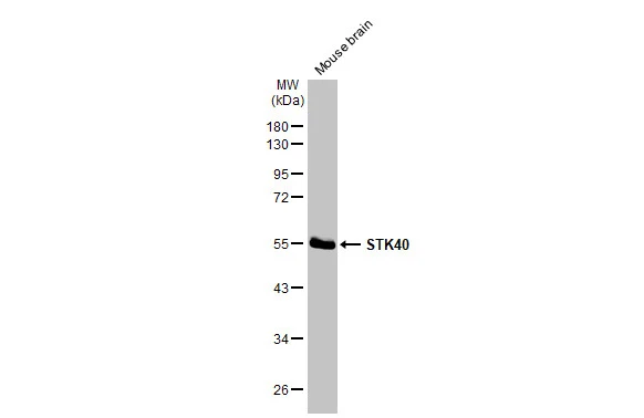 Mouse tissue extract (50 μg) was separated by 10% SDS-PAGE, and the membrane was blotted with STK40 antibody [N1N3] (GTX111412) diluted at 1:1000. The HRP-conjugated anti-rabbit IgG antibody (GTX213110-01) was used to detect the primary antibody.