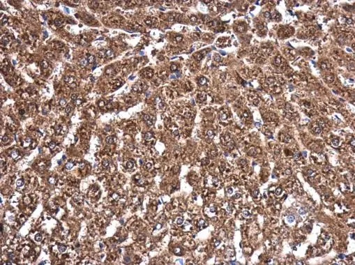 MVD antibody [N1C1] detects MVD protein at cytoplasm in rat liver by immunohistochemical analysis. Sample: Paraffin-embedded rat liver. MVD antibody [N1C1] (GTX111425) diluted at 1:400. 
 Antigen Retrieval: Citrate buffer, pH 6.0, 15 min