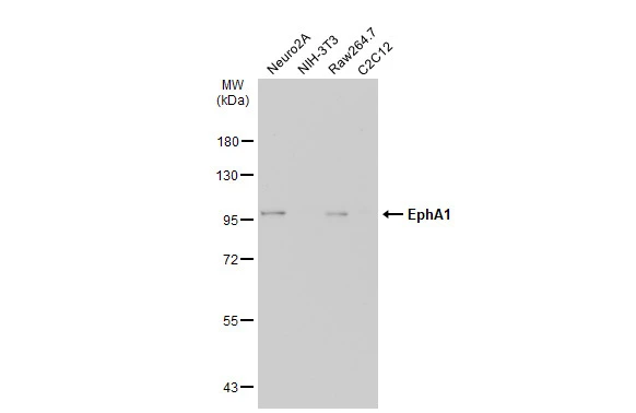 Various whole cell extracts (30 μg) were separated by 7.5% SDS-PAGE, and the membrane was blotted with EphA1 antibody [C1C3-2] (GTX111449) diluted at 1:1000. The HRP-conjugated anti-rabbit IgG antibody (GTX213110-01) was used to detect the primary antibody, and the signal was developed with Trident ECL plus-Enhanced.