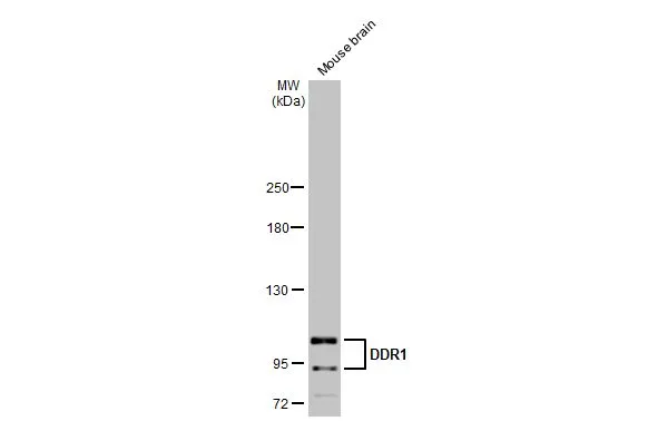 Mouse tissue extract (50 μg) was separated by 5% SDS-PAGE, and the membrane was blotted with DDR1 antibody [N1N3] (GTX111453) diluted at 1:500. The HRP-conjugated anti-rabbit IgG antibody (GTX213110-01) was used to detect the primary antibody.