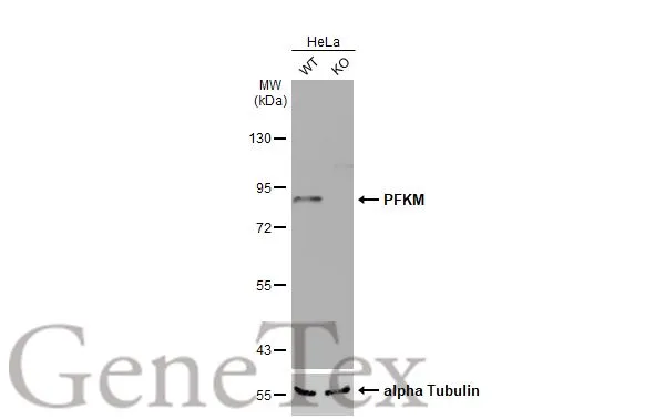 Wild-type (WT) and PFKM knockout (KO) HeLa cell extracts (30 μg) were separated by 7.5% SDS-PAGE, and the membrane was blotted with PFKM antibody [N1N2-2], N-term (GTX111461) diluted at 1:500. The HRP-conjugated anti-rabbit IgG antibody (GTX213110-01) was used to detect the primary antibody.