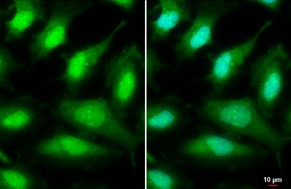 ULK2 antibody [C2C3], C-term detects ULK2 protein at cytoplasm and nucleus by immunofluorescent analysis. Sample: HeLa cells were fixed in ice-cold MeOH for 5 min. Green: ULK2 stained by ULK2 antibody [C2C3], C-term (GTX111476) diluted at 1:500. Blue: Hoechst 33342 staining. Scale bar= 10 μm.