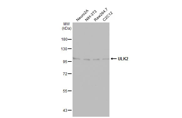 Various whole cell extracts (30 μg) were separated by 7.5% SDS-PAGE, and the membrane was blotted with ULK2 antibody [C2C3], C-term (GTX111476) diluted at 1:500. The HRP-conjugated anti-rabbit IgG antibody (GTX213110-01) was used to detect the primary antibody.