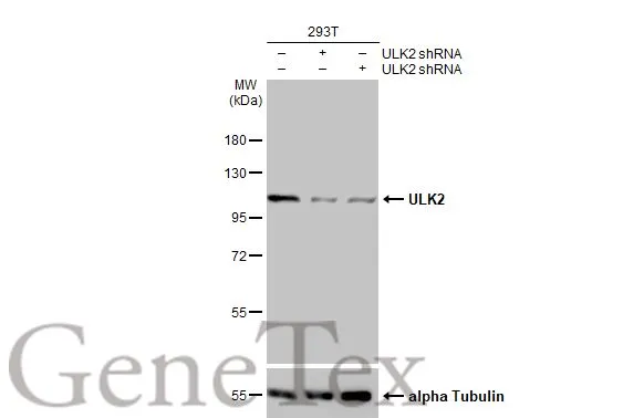 Non-transfected (–) and transfected (+) 293T whole cell extracts (30 μg) were separated by 7.5% SDS-PAGE, and the membrane was blotted with ULK2 antibody [C2C3], C-term (GTX111476) diluted at 1:1000. The HRP-conjugated anti-rabbit IgG antibody (GTX213110-01) was used to detect the primary antibody.
