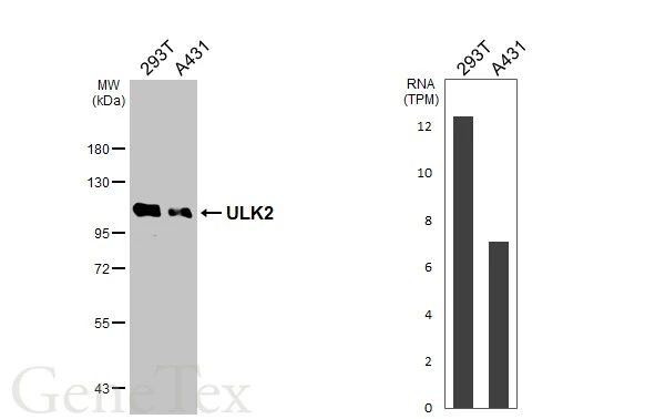 Various whole cell extracts (30 μg) were separated by 7.5% SDS-PAGE, and the membrane was blotted with ULK2 antibody [C2C3], C-term (GTX111476) diluted at 1:500. The HRP-conjugated anti-rabbit IgG antibody (GTX213110-01) was used to detect the primary antibody.Corresponding RNA expression data for the same cell lines are based on Human Protein Atlas program.