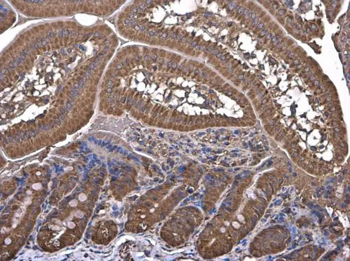 HKDC1 antibody detects HKDC1 protein at cytoplasm in mouse duodenum by immunohistochemical analysis. Sample: Paraffin-embedded mouse duodenum. HKDC1 antibody (GTX111506) diluted at 1:500.
Antigen Retrieval: Citrate buffer, pH 6.0, 15 min