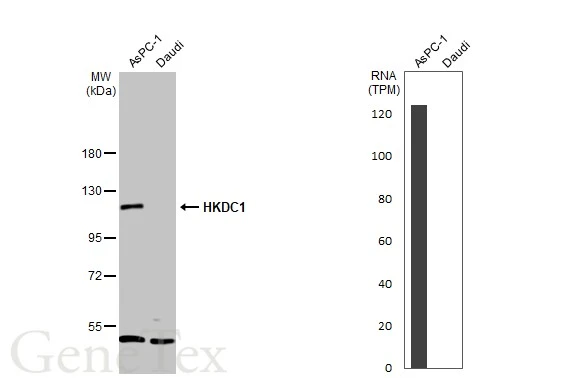 Various whole cell extracts (30 μg) were separated by 7.5% SDS-PAGE, and the membrane was blotted with HKDC1 antibody (GTX111506) diluted at 1:2000. The HRP-conjugated anti-rabbit IgG antibody (GTX213110-01) was used to detect the primary antibody. Corresponding RNA expression data for the same cell lines are based on Human Protein Atlas program.