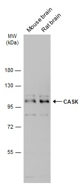Various tissue extracts (50 μg) were separated by 7.5% SDS-PAGE, and the membrane was blotted with CASK antibody (GTX111513) diluted at 1:3000. The HRP-conjugated anti-rabbit IgG antibody (GTX213110-01) was used to detect the primary antibody.