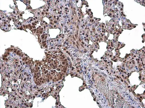 CASK antibody detects CASK protein at cytoplasm and nucleus in mouse lung by immunohistochemical analysis. Sample: Paraffin-embedded mouse lung. CASK antibody (GTX111513) diluted at 1:500.