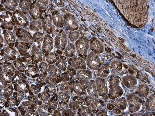Hexokinase II antibody detects Hexokinase II protein at cytoplasm in rat stomach by immunohistochemical analysis. Sample: Paraffin-embedded rat stomach. Hexokinase II antibody (GTX111525) diluted at 1:500. 
 Antigen Retrieval: Citrate buffer, pH 6.0, 15 min