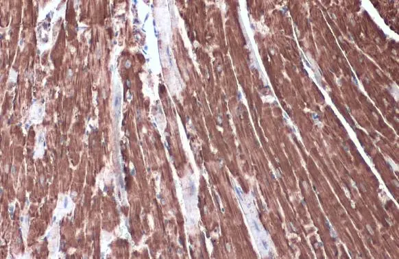 Hexokinase II antibody detects Hexokinase II protein at cytoplasm by immunohistochemical analysis. Sample: Paraffin-embedded mouse heart. Hexokinase II stained by Hexokinase II antibody (GTX111525) diluted at 1:2000. Antigen Retrieval: Citrate buffer, pH 6.0, 15 min
