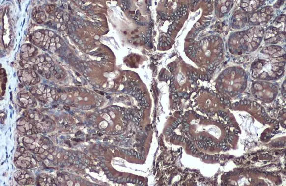 Hexokinase II antibody detects Hexokinase II protein at cytoplasm by immunohistochemical analysis. Sample: Paraffin-embedded rat colon. Hexokinase II stained by Hexokinase II antibody (GTX111525) diluted at 1:2000. Antigen Retrieval: Citrate buffer, pH 6.0, 15 min