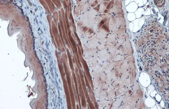 Hexokinase II antibody detects Hexokinase II protein at cytoplasm by immunohistochemical analysis. Sample: Paraffin-embedded rat muscle. Hexokinase II stained by Hexokinase II antibody (GTX111525) diluted at 1:1000. Antigen Retrieval: Citrate buffer, pH 6.0, 15 min