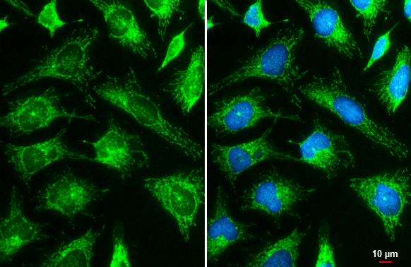 Hexokinase II antibody detects Hexokinase II protein at mitochondria by immunofluorescent analysis. Sample: HeLa cells were fixed in ice-cold MeOH for 5 min. Green: Hexokinase II stained by Hexokinase II antibody (GTX111525) diluted at 1:2000. Blue: Fluoroshield with DAPI (GTX30920). Scale bar= 10 μm.