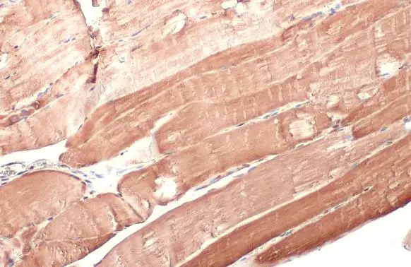 Hexokinase II antibody detects Hexokinase II protein at cytoplasm by immunohistochemical analysis. Sample: Paraffin-embedded mouse muscle. Hexokinase II stained by Hexokinase II antibody (GTX111525) diluted at 1:500. Antigen Retrieval: Citrate buffer, pH 6.0, 15 min