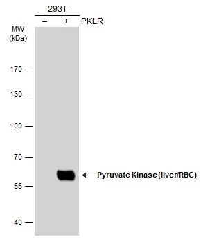 Immunohistochemical analysis of paraffin-embedded NCIN87 xenograft,using Pyruvate Kinase (liver/RBC)(GTX111536) antibody at 1:500 dilution. Antigen Retrieval: Citrate buffer,pH 6.0,15 min