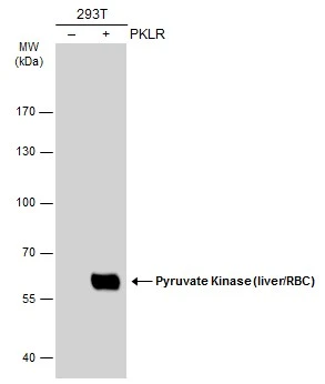 Non-transfected (–) and transfected (+) 293T whole cell extracts (30 μg) were separated by 7.5% SDS-PAGE, and the membrane was blotted with Pyruvate Kinase (liver/RBC) antibody (GTX111536) diluted at 1:1000. The HRP-conjugated anti-rabbit IgG antibody (GTX213110-01) was used to detect the primary antibody.