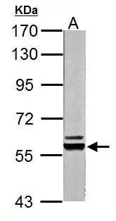 Pyruvate Kinase (liver/RBC) antibody detects Pyruvate Kinase (liver/RBC) protein by Western blot analysis. A. 20 ug Rat liver lysate/extract 7.5% SDS-PAGE Pyruvate Kinase (liver/RBC) antibody (GTX111536) dilution: 1:10000