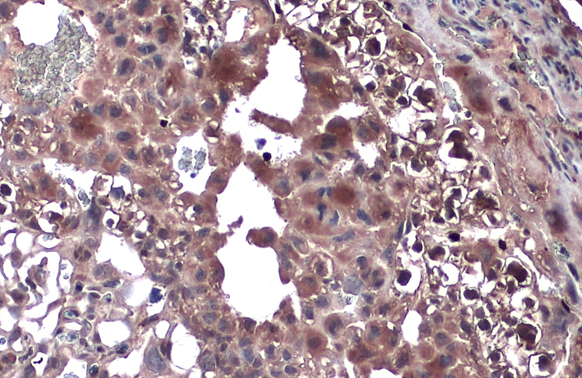 TLR9 antibody [N1N2], N-term detects TLR9 protein by immunohistochemical analysis. Sample: Paraffin-embedded mouse placenta. TLR9 stained by TLR9 antibody [N1N2], N-term (GTX111547) diluted at 1:500. Antigen Retrieval: Citrate buffer, pH 6.0, 15 min