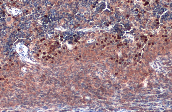 TLR9 antibody [N1N2], N-term detects TLR9 protein by immunohistochemical analysis. Sample: Paraffin-embedded mouse spleen. TLR9 stained by TLR9 antibody [N1N2], N-term (GTX111547) diluted at 1:500. Antigen Retrieval: Citrate buffer, pH 6.0, 15 min