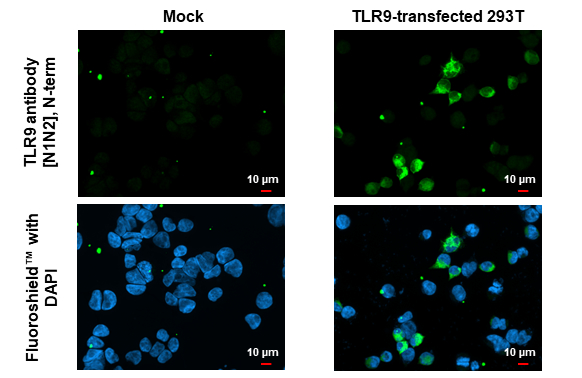 TLR9 antibody [N1N2], N-term detects TLR9 protein by immunofluorescent analysis. Sample: Mock and transfected 293T cells were fixed in 4% paraformaldehyde at RT for 15 min. Green: TLR9 stained by TLR9 antibody [N1N2], N-term (GTX111547) diluted at 1:500. Blue: Fluoroshield with DAPI (GTX30920).
