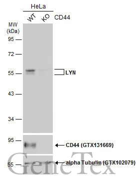 Wild-type (WT) and CD44 knockout (KO) HeLa cell extracts (30 μg) were separated by 10% SDS-PAGE, and the membrane was blotted with LYN antibody (GTX111584) diluted at 1:500. The HRP-conjugated anti-rabbit IgG antibody (GTX213110-01) was used to detect the primary antibody.