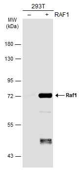 Non-transfected (–) and transfected (+) 293T whole cell extracts (30 μg) were separated by 7.5% SDS-PAGE, and the membrane was blotted with Raf1 antibody [N1C1-2] (GTX111588) diluted at 1:1000. The HRP-conjugated anti-rabbit IgG antibody (GTX213110-01) was used to detect the primary antibody.