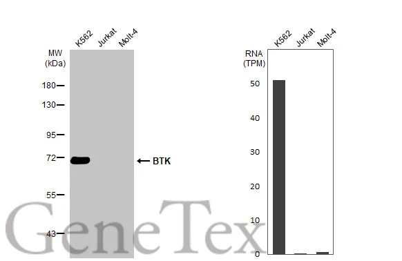 Various whole cell extracts (30 μg) were separated by 7.5% SDS-PAGE, and the membrane was blotted with BTK antibody (GTX111592) diluted at 1:1000. The HRP-conjugated anti-rabbit IgG antibody (GTX213110-01) was used to detect the primary antibody.Corresponding RNA expression data for the same cell lines are based on Human Protein Atlas program.