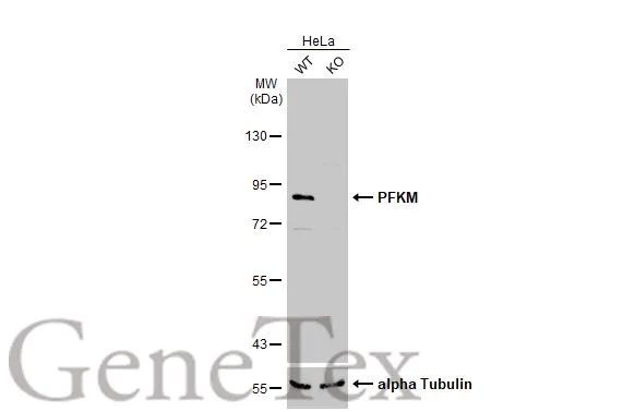 PFKM antibody [C1C3]
