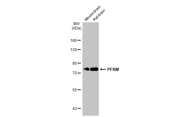 PFKM antibody [C1C3]