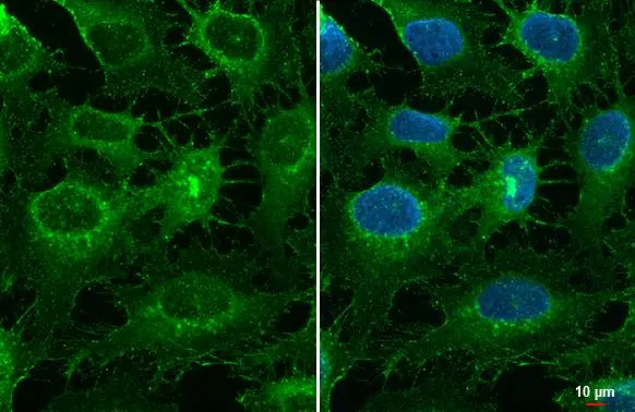 Collagen III antibody [C2C3-2], C-term detects Collagen III protein at cell membrane by immunofluorescent analysis. Sample: HeLa cells were fixed in ice-cold MeOH for 5 min. Green: Collagen III stained by Collagen III antibody [C2C3-2], C-term (GTX111643) diluted at 1:500.