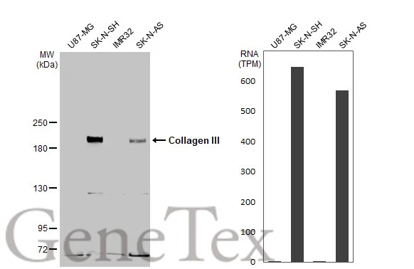 Various whole cell extracts (30 μg) were separated by 5% SDS-PAGE, and the membrane was blotted with Collagen III antibody [C2C3-2], C-term (GTX111643) diluted at 1:2000. The HRP-conjugated anti-rabbit IgG antibody (GTX213110-01) was used to detect the primary antibody. Corresponding RNA expression data for the same cell lines are based on Human Protein Atlas program.