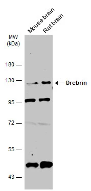 Various tissue extracts (50 μg) were separated by 7.5% SDS-PAGE, and the membrane was blotted with Drebrin antibody (GTX111649) diluted at 1:3000. The HRP-conjugated anti-rabbit IgG antibody (GTX213110-01) was used to detect the primary antibody.