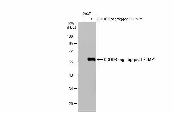 Non-transfected (–) and transfected (+) 293T whole cell extracts (30 μg) were separated by 10% SDS-PAGE, and the membrane was blotted with EFEMP1 antibody (GTX111656) diluted at 1:5000. The HRP-conjugated anti-rabbit IgG antibody (GTX213110-01) was used to detect the primary antibody.