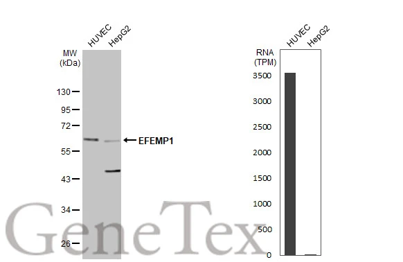 Various whole cell extracts (50 μg) were separated by 10% SDS-PAGE, and the membrane was blotted with EFEMP1 antibody (GTX111656) diluted at 1:1000. The HRP-conjugated anti-rabbit IgG antibody (GTX213110-01) was used to detect the primary antibody, and the signal was developed with Trident ECL plus-Enhanced. Corresponding RNA expression data for the same cell lines are based on Human Protein Atlas program.