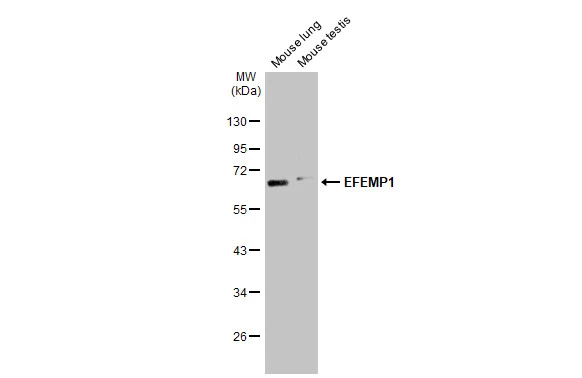 Various tissue extracts (50 μg) were separated by 10% SDS-PAGE, and the membrane was blotted with EFEMP1 antibody (GTX111657) diluted at 1:1000. The HRP-conjugated anti-rabbit IgG antibody (GTX213110-01) was used to detect the primary antibody, and the signal was developed with Trident femto Western HRP Substrate. Various tissue extracts (50 μg) were separated by 10% SDS-PAGE, and the membrane was blotted with EFEMP1 antibody (GTX111657) diluted at 1:1000. The HRP-conjugated anti-rabbit IgG antibody (GTX213110-01) was used to detect the primary antibody, and the signal was developed with Trident femto Western HRP Substrate.