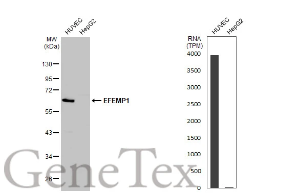 Various whole cell extracts (30 μg) were separated by 10% SDS-PAGE, and the membrane was blotted with EFEMP1 antibody (GTX111657) diluted at 1:1000. The HRP-conjugated anti-rabbit IgG antibody (GTX213110-01) was used to detect the primary antibody.Corresponding RNA expression data for the same cell lines are based on Human Protein Atlas program. Various whole cell extracts (30 μg) were separated by 10% SDS-PAGE, and the membrane was blotted with EFEMP1 antibody (GTX111657) diluted at 1:1000. The HRP-conjugated anti-rabbit IgG antibody (GTX213110-01) was used to detect the primary antibody.Corresponding RNA expression data for the same cell lines are based on Human Protein Atlas program.