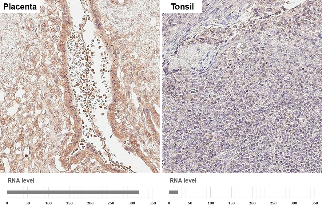 EFEMP1 antibody detects EFEMP1 protein by immunohistochemical analysis. Sample: Paraffin-embedded human tissues. EFEMP1 stained by EFEMP1 antibody (GTX111657) diluted at 1:500. Antigen Retrieval: Tris-EDTA buffer, pH 9.0, 15 min EFEMP1 antibody detects EFEMP1 protein by immunohistochemical analysis. Sample: Paraffin-embedded human tissues. EFEMP1 stained by EFEMP1 antibody (GTX111657) diluted at 1:500. Antigen Retrieval: Tris-EDTA buffer, pH 9.0, 15 min