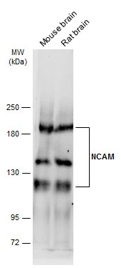 Various tissue extracts (50 μg) were separated by 5% SDS-PAGE, and the membrane was blotted with NCAM antibody (GTX111684) diluted at 1:10000. The HRP-conjugated anti-rabbit IgG antibody (GTX213110-01) was used to detect the primary antibody, and the signal was developed with Trident ECL plus-Enhanced.